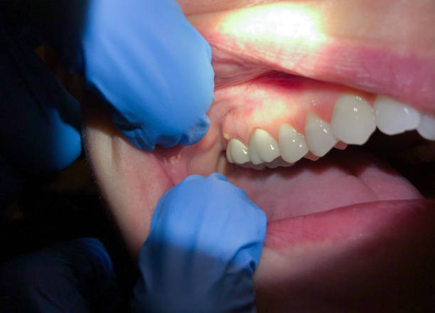 Best Emergency Root Canal Therapy in East Dundee, IL